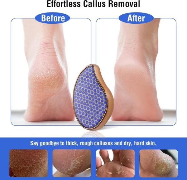 Dual-Action Glass Foot File - Callus Scraper & Body Hair Eraser for Feet, Arms, Back & Legs | Spa-Quality Exfoliation - Image 3