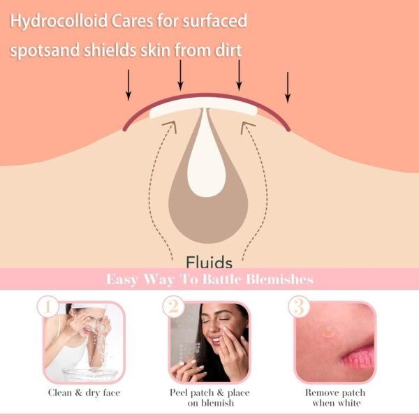 Acne Spot Patches – Hydrocolloid Pimple Stickers for Face, Emergency Blemish & Zit Cover (72 Count) - Image 2