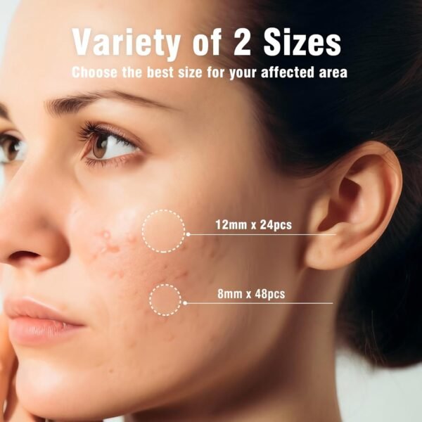 Acne Spot Patches – Hydrocolloid Pimple Stickers for Face, Emergency Blemish & Zit Cover (72 Count) - Image 4